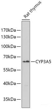 Immunohistochemistry of paraffin-embedded Human liver cancer using ALG2 Polyclonal Antibody at dilution of  1:100 (40x lens).