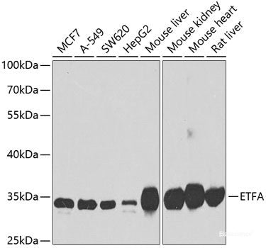 Immunohistochemistry of paraffin-embedded Human kidney using TGS1 Polyclonal Antibody at dilution of  1:100 (40x lens).