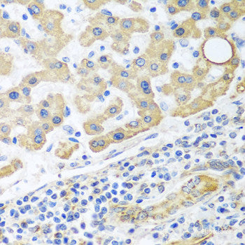 Immunohistochemistry of paraffin-embedded Human stomach using SCG3 Polyclonal Antibody at dilution of  1:100 (40x lens).