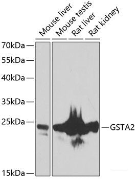 Immunohistochemistry of paraffin-embedded Human stomach using SPICE1 Polyclonal Antibody at dilution of  1:100 (40x lens).