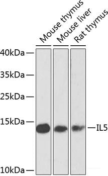 Immunofluorescence analysis of HeLa cells using ACVR2B Polyclonal Antibody at dilution of  1:100 (40x lens). Blue: DAPI for nuclear staining.