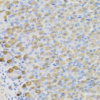 Immunofluorescence analysis of U2OS cells using COG4 Polyclonal Antibody at dilution of  1:100. Blue: DAPI for nuclear staining.