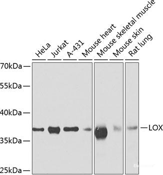 Immunohistochemistry of paraffin-embedded Rat heart using ALDH9A1 Polyclonal Antibody