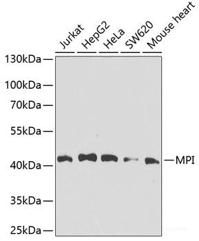 Immunohistochemistry of paraffin-embedded Human kidney using UBA6 Polyclonal Antibody at dilution of  1:100 (40x lens).