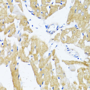 Immunohistochemistry of paraffin-embedded Human stomach using ALKBH4 Polyclonal Antibody at dilution of  1:100 (40x lens).