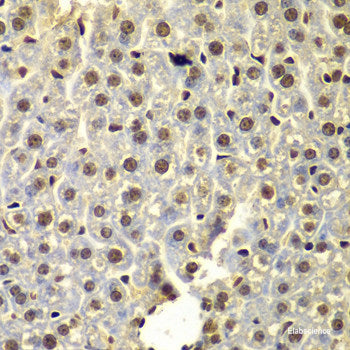 Immunofluorescence analysis of U-2 OS cells using ITPR1 Polyclonal Antibody at dilution of  1:100. Blue: DAPI for nuclear staining.