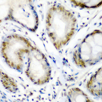 Immunohistochemistry of paraffin-embedded Rat spleen using UBASH3B Polyclonal Antibody at dilution of  1:100 (40x lens).