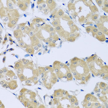 Immunofluorescence analysis of U2OS cells using MEF2A Polyclonal Antibody at dilution of  1:100. Blue: DAPI for nuclear staining.