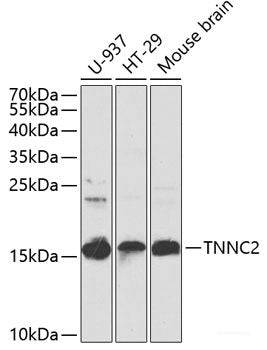 Immunohistochemistry of paraffin-embedded Human colon using MTX1 Polyclonal Antibody at dilution of  1:100 (40x lens).