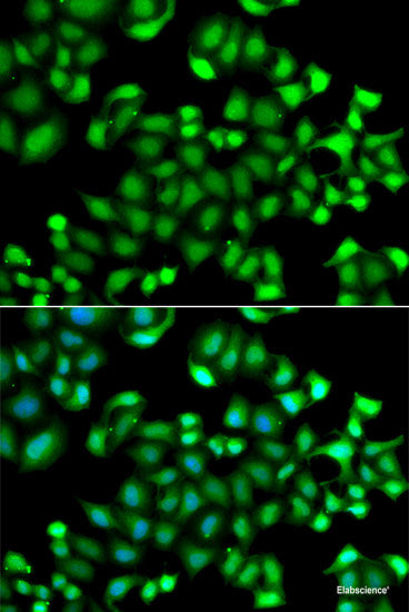 Western blot analysis of extracts of various cell lines using TFG Polyclonal Antibody at dilution of 1:1000.