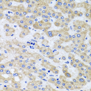 Immunofluorescence analysis of A549 cells using FRK Polyclonal Antibody