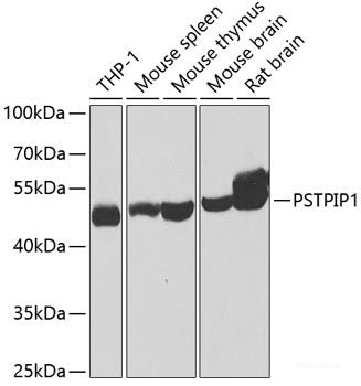 Immunohistochemistry of paraffin-embedded Mouse lung using WHSC1 Polyclonal Antibody at dilution of  1:100 (40x lens).