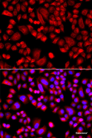 Immunohistochemistry of paraffin-embedded Mouse stomach using IRS2 Polyclonal Antibody at dilution of  1:100 (40x lens).