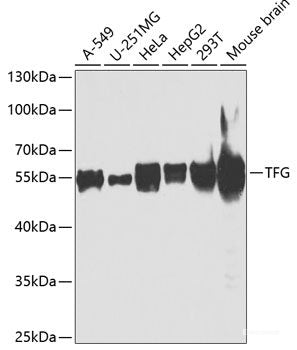 Western blot analysis of extracts of various cell lines using FUBP3 Polyclonal Antibody at dilution of 1:1000.