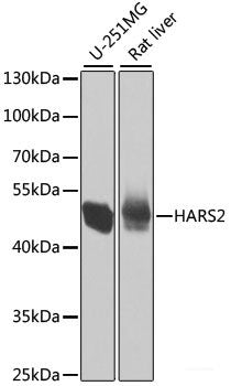 Immunofluorescence analysis of A549 cells using ASCC3 Polyclonal Antibody