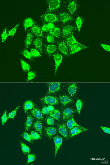Western blot analysis of extracts of Mouse testis using CHIC2 Polyclonal Antibody at dilution of 1:1000.