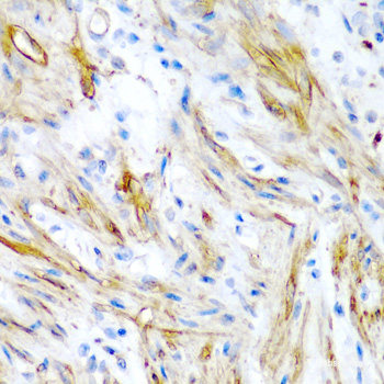 Immunofluorescence analysis of MCF-7 cells using ATMIN Polyclonal Antibody