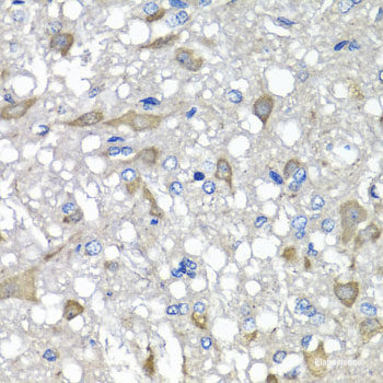 Immunohistochemistry of paraffin-embedded Rat brain using GABARAPL2 Polyclonal Antibody at dilution of  1:200 (40x lens).