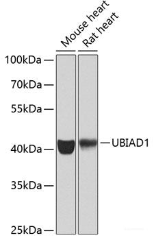 Western blot analysis of extracts of various cell lines using ALG1 Polyclonal Antibody at dilution of 1:1000.