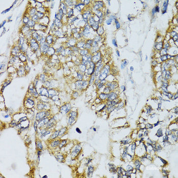 Immunofluorescence analysis of A549 cells using RNF125 Polyclonal Antibody