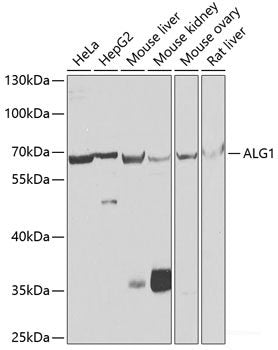 Western blot analysis of extracts of various cell lines using LSM2 Polyclonal Antibody at dilution of 1:1000.