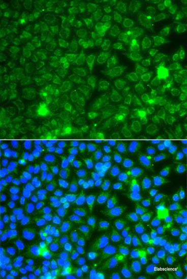 Western blot analysis of extracts of various cell lines using OPA3 Polyclonal Antibody at dilution of 1:1000.