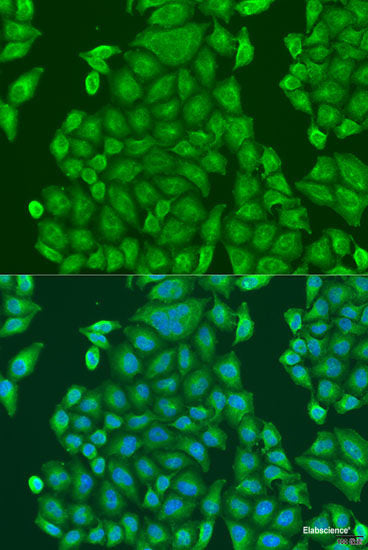 Immunofluorescence analysis of U2OS cells using MLH3 Polyclonal Antibody at dilution of  1:100. Blue: DAPI for nuclear staining.