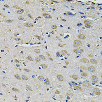 Immunofluorescence analysis of U2OS cells using EGLN3 Polyclonal Antibody at dilution of  1:100. Blue: DAPI for nuclear staining.