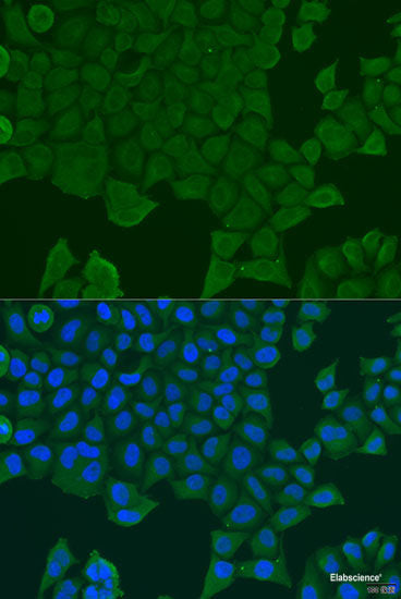 Immunohistochemistry of paraffin-embedded Human stomach using EFHC1 Polyclonal Antibody at dilution of  1:100 (40x lens).