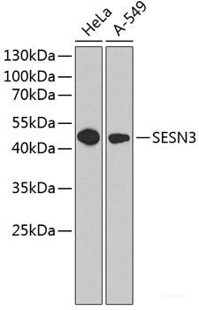 Immunofluorescence analysis of U2OS cells using MERTK Polyclonal Antibody at dilution of  1:100. Blue: DAPI for nuclear staining.