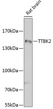 Immunofluorescence analysis of A549 cells using CBLC Polyclonal Antibody