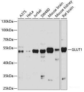Western blot analysis of extracts of various cell lines using ELAC2 Polyclonal Antibody at dilution of 1:1000.