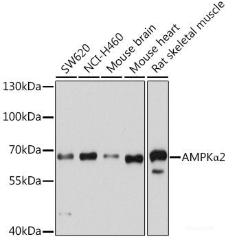 Western blot analysis of extracts of various cell lines using TARBP2 Polyclonal Antibody at dilution of 1:1000.