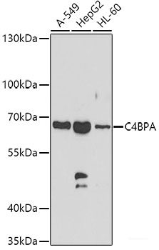Immunofluorescence analysis of A549 cells using GBA3 Polyclonal Antibody