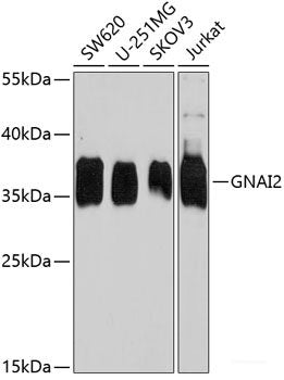 Immunohistochemistry of paraffin-embedded Rat brain using VPS37A Polyclonal Antibody at dilution of  1:100 (40x lens).