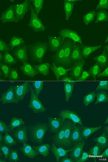 Immunohistochemistry of paraffin-embedded Human kidney using CALCOCO1 Polyclonal Antibody at dilution of  1:100 (40x lens).