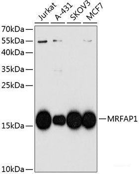 Immunohistochemistry of paraffin-embedded Mouse brain using PTK7 Polyclonal Antibody at dilution of  1:100 (40x lens).