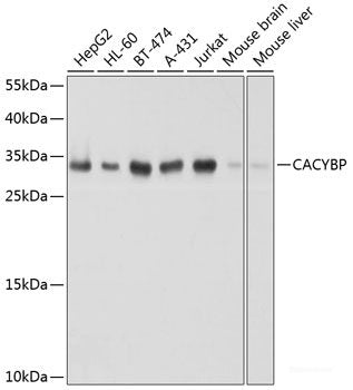 Immunohistochemistry of paraffin-embedded Rat kidney using RNASEL Polyclonal Antibody at dilution of  1:100 (40x lens).