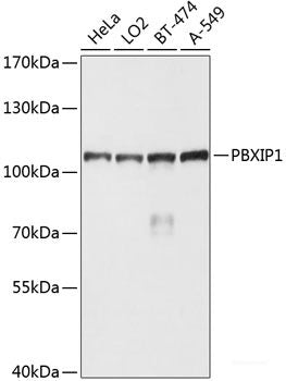 Immunohistochemistry of paraffin-embedded Human liver damage using SLC2A2 Polyclonal Antibody at dilution of  1:100 (40x lens).