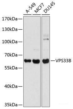 Immunohistochemistry of paraffin-embedded Human prostate using ABCC3 Polyclonal Antibody at dilution of  1:100 (40x lens).