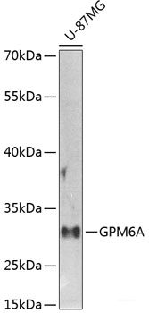 Western blot analysis of extracts of Mouse lung using MAGI3 Polyclonal Antibody at dilution of 1:1000.