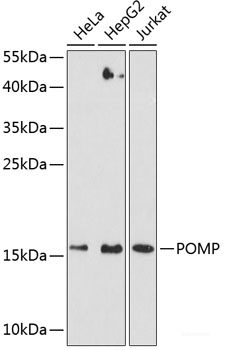 Immunohistochemistry of paraffin-embedded Human prostate using FABP12 Polyclonal Antibody at dilution of  1:100 (40x lens).