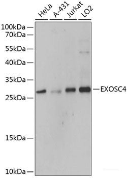 Western blot analysis of extracts of various cell lines using GLDC Polyclonal Antibody at dilution of 1:1000.