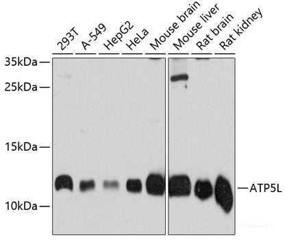 Western blot analysis of extracts of various cell lines using MARS Polyclonal Antibody at dilution of 1:1000.