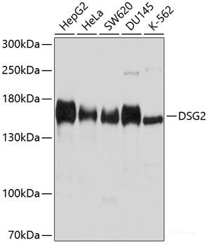 Western blot analysis of extracts of various cell lines using UBE2Q2 Polyclonal Antibody at dilution of 1:1000.