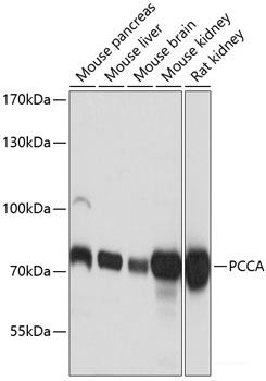 Immunohistochemistry of paraffin-embedded Rat kidney using Phospho-ABL1(Y245) Polyclonal Antibody at dilution of  1:100 (40x lens).