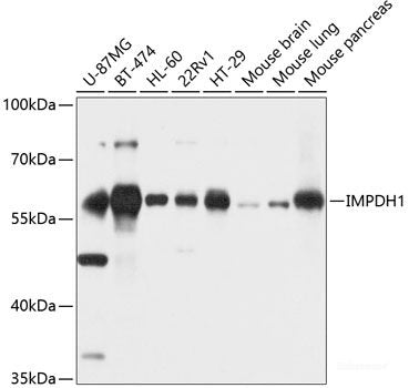 Immunofluorescence analysis of MCF-7 cells using Phospho-ATM(S1981) Polyclonal Antibody
