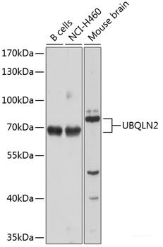 Immunofluorescence analysis of MCF-7 cells using Phospho-Dnmt1(pY399) Polyclonal Antibody