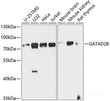 Western blot analysis of extracts of various cell lines using Phospho-MAP2K1(S217) Polyclonal Antibody at dilution of 1:1000. HeLa cells were treated by PMA/TPA (200 nM) at 37°C for 15 minutes after serum-starvation overnight.