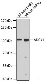 Western blot analysis of extracts of HeLa cells using Phospho-MAP2K1(pS221) Polyclonal Antibody at dilution of 1:1000. HeLa cells were treated by PMA/TPA (200nM) for 15 minutes after serum-starvation overnight.